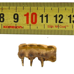 Lot d'or dentaire, poids brut 11,80 grs