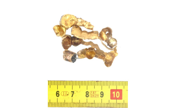 Lot d'or dentaire, poids 18,70 grs, plus